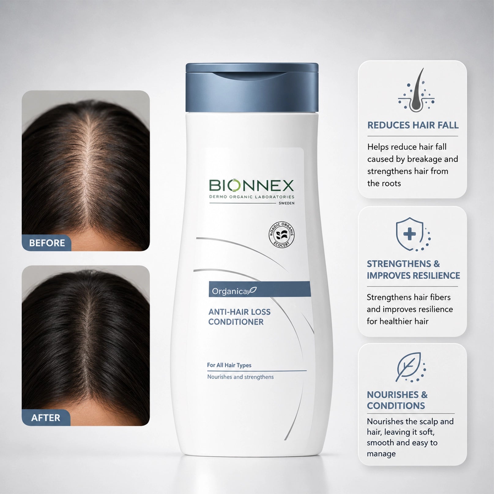 Bionnex Organ Anti Hair Loss Cond All Type 300ml