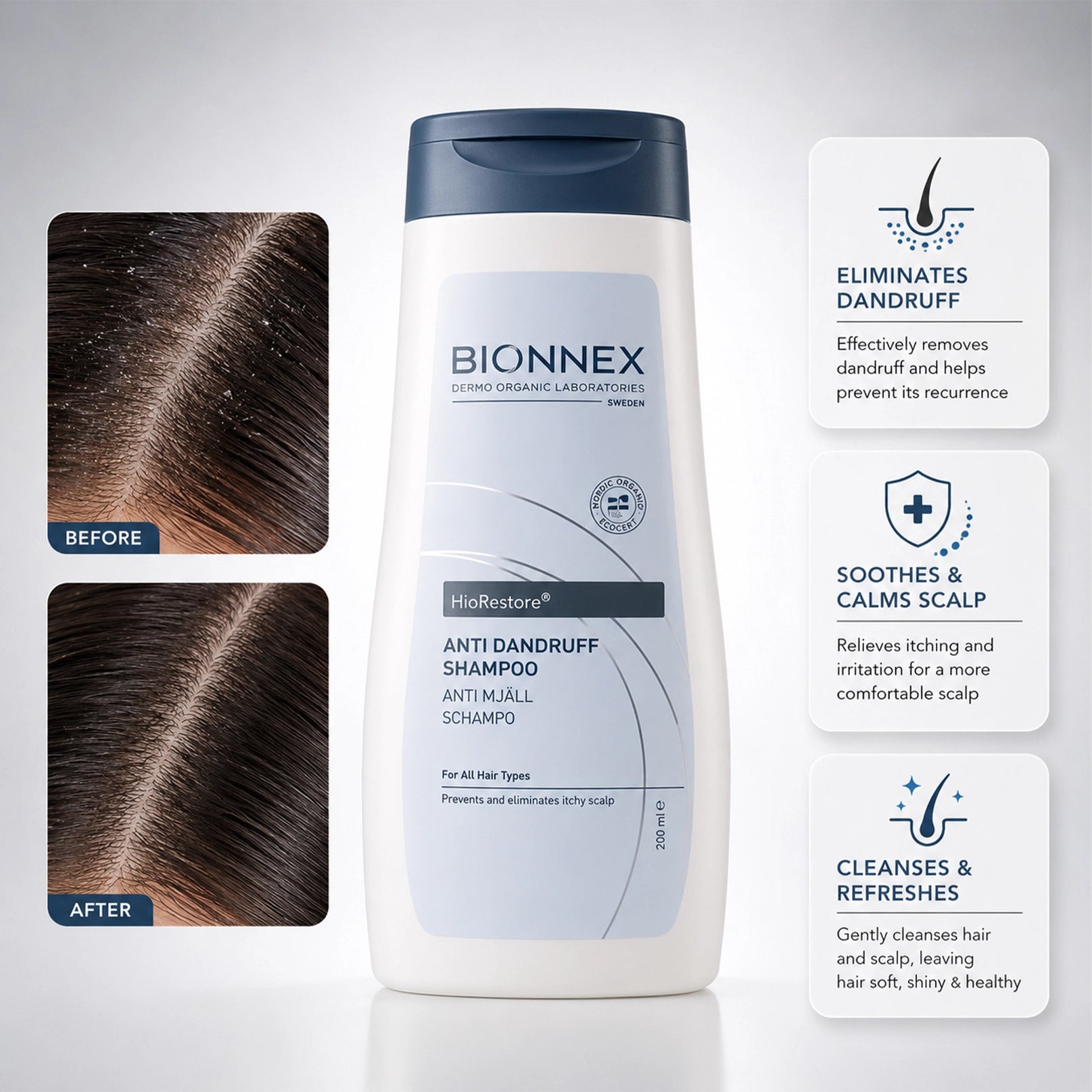 Bionnex Organ Anti Dandruff Shamp All Type 300ml