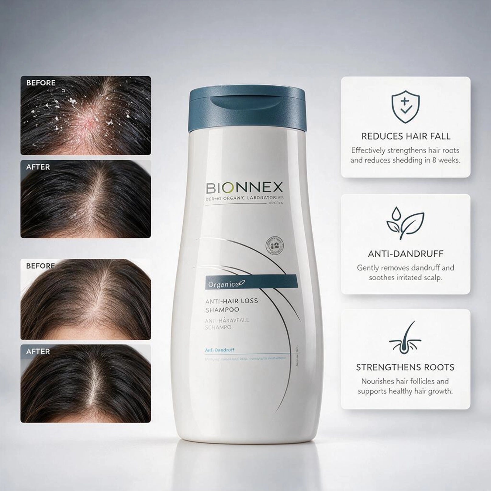 Bionnex Organ Anti Hair Loss Shamp Antidandruff 300ml
