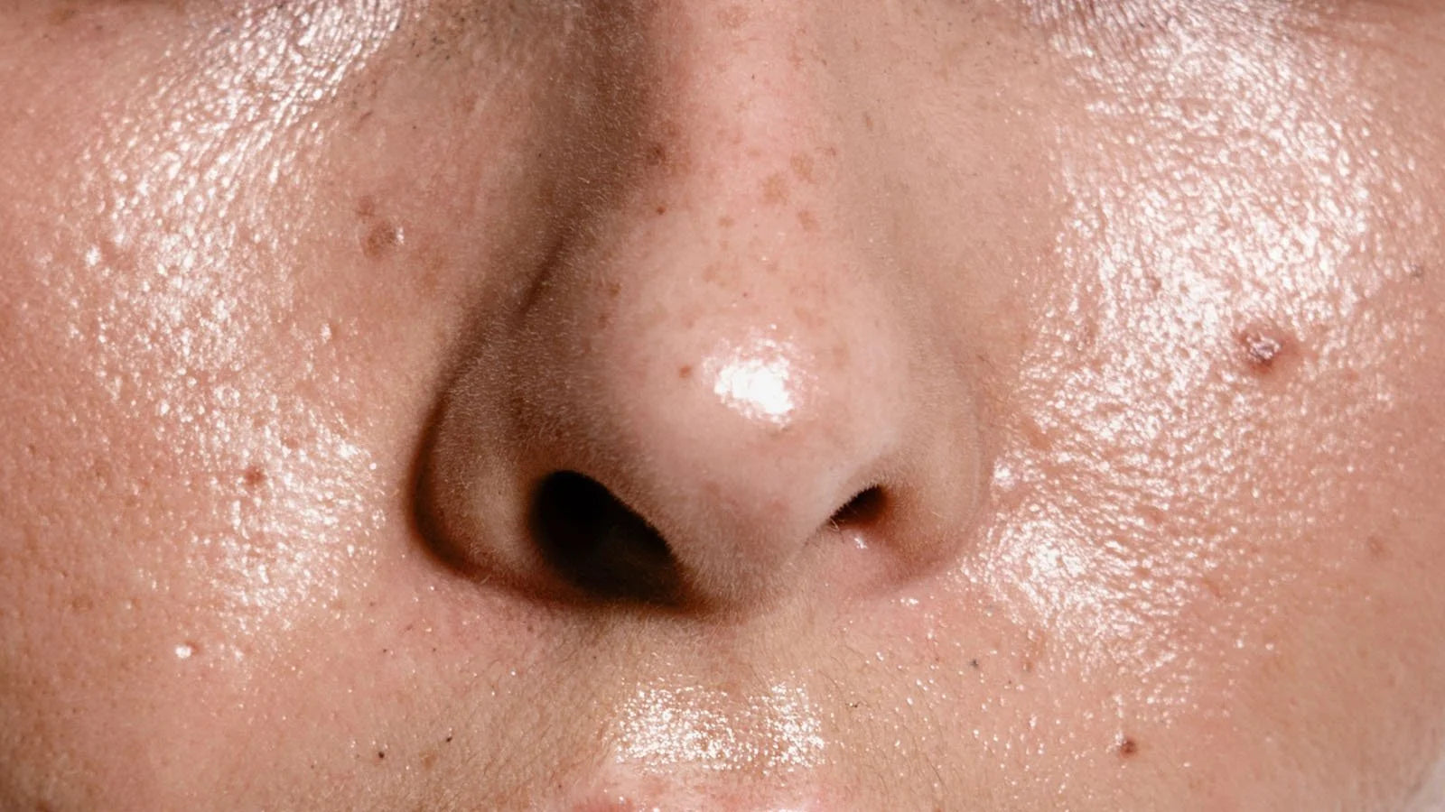 البشرة الدهنية والمختلطة