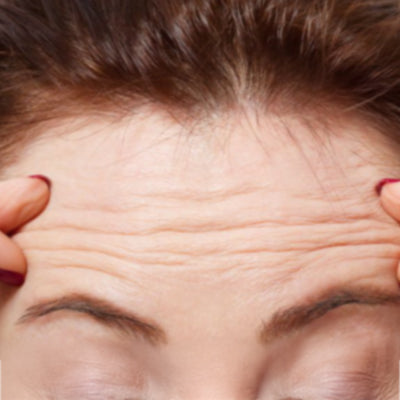 Wrinkles & Fine Lines