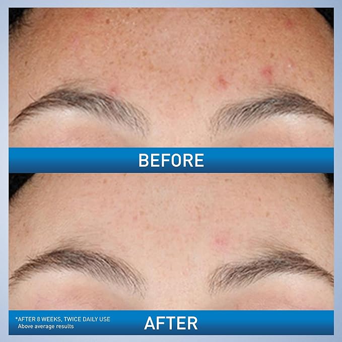 CERAVE RETINOL SERUM 30ML