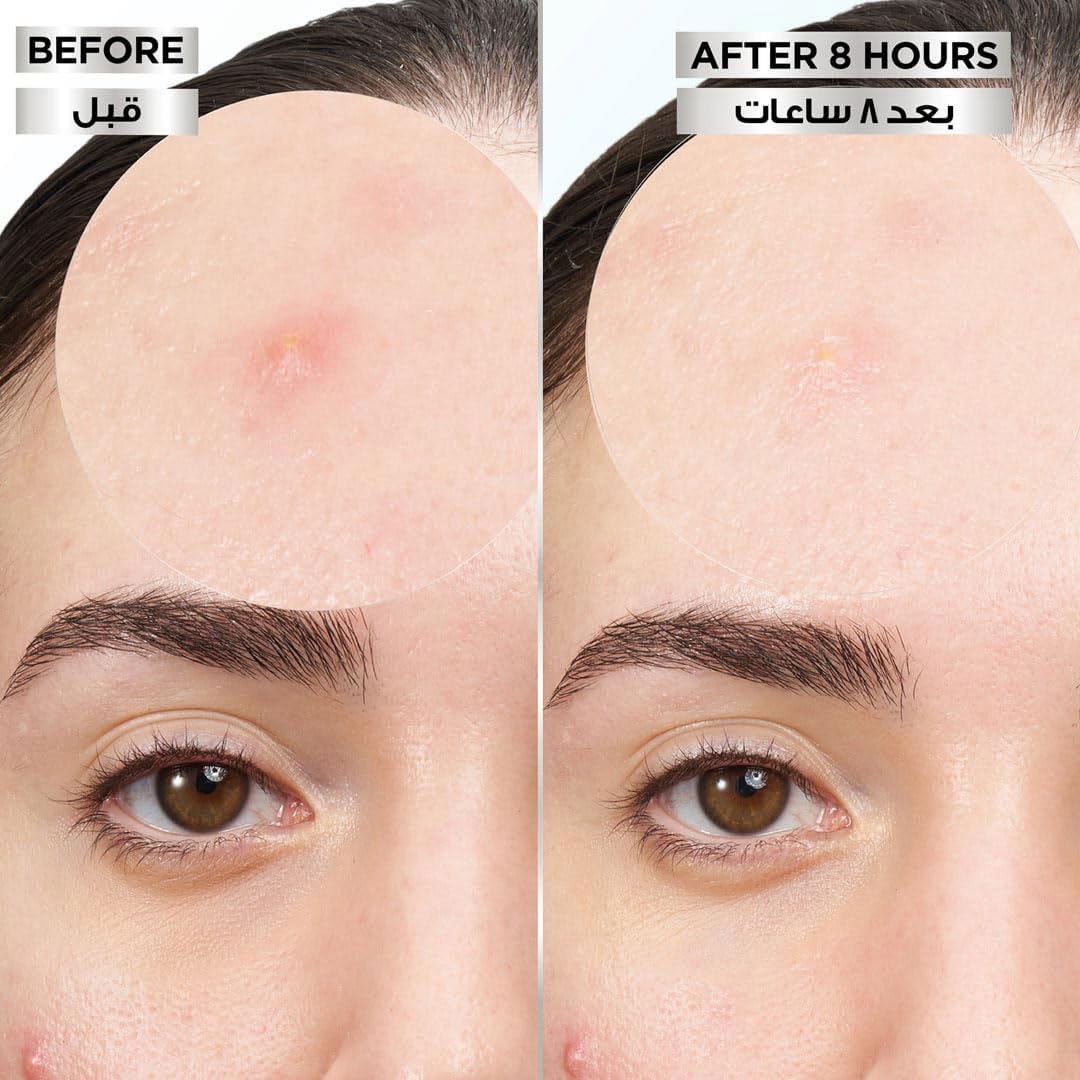 GARNIER PIMPLE PATCH INVISIBLE 22PCS