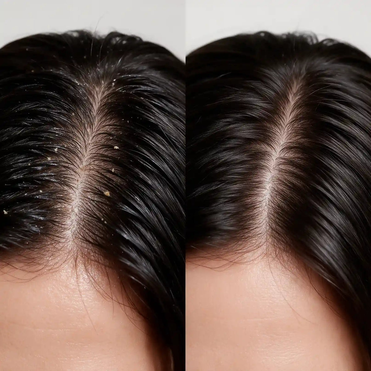 Uriage DS Hair Regulating Anti-Dandruff Lotion 100ml